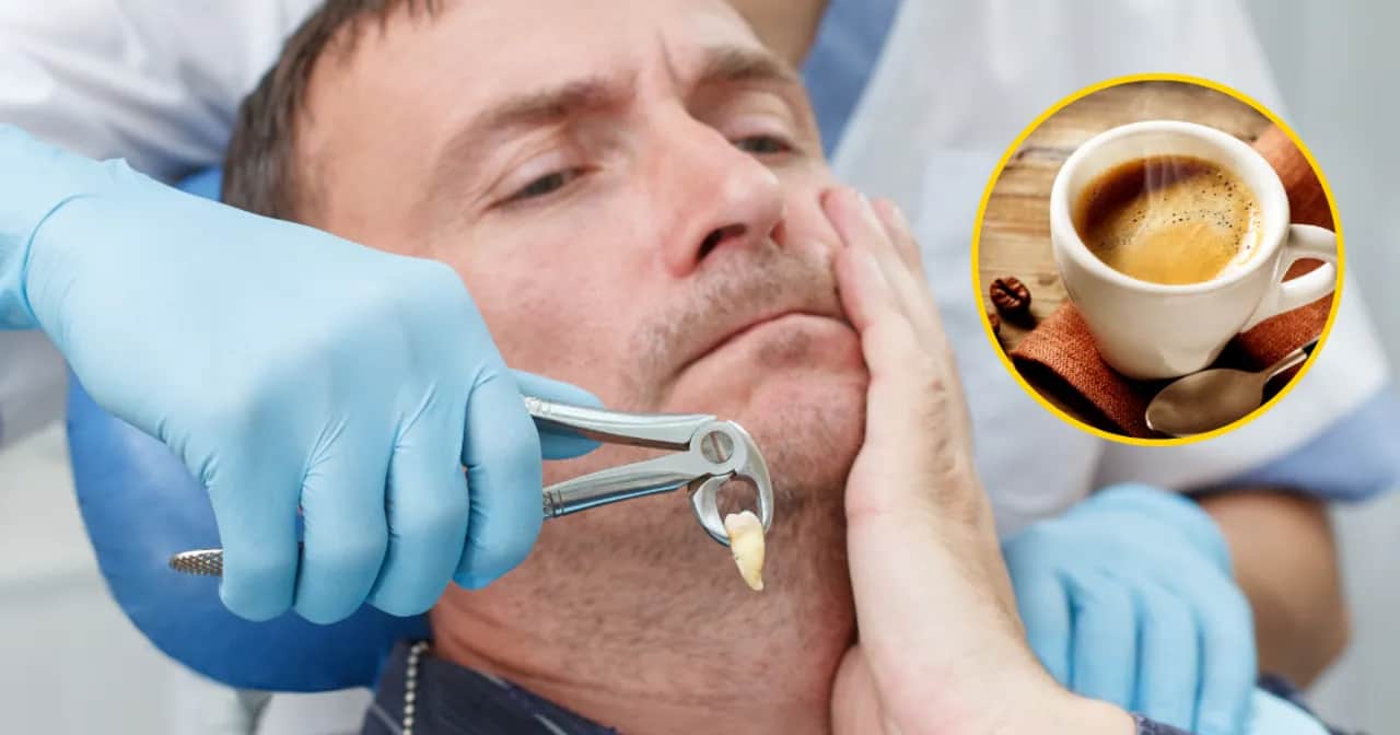 Kawa po wyrwaniu zęba: Ile czekać, by uniknąć suchego zębodołu?
