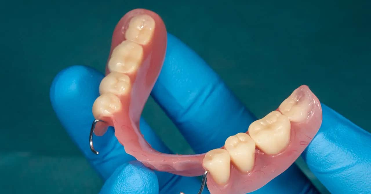 Aparat na zęby z NFZ: Kto dostanie refundację i na jakich zasadach?