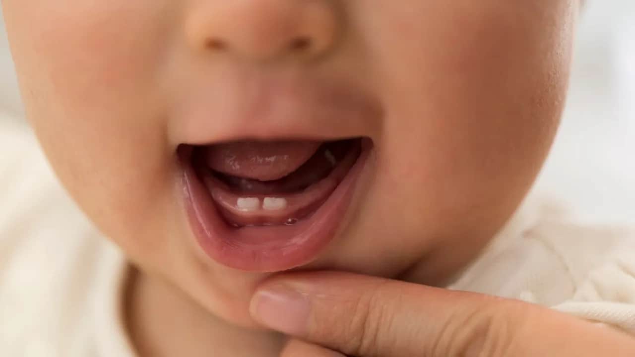 Opuchnięte dziąsła u niemowlaka: Kiedy ząbkowanie, kiedy lekarz?