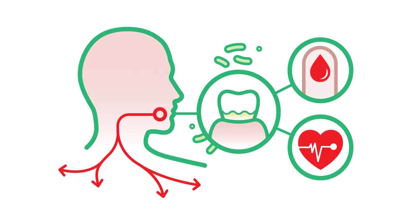 Krwawiące dziąsła? Odkryj kluczowe witaminy dla ich zdrowia!